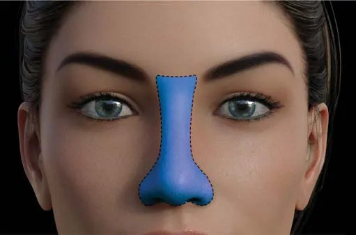Fig 2. Schematic of the nasal aesthetic subunit (dorsum, tip, alae) with its vascular territory outlined, on a frontal face.